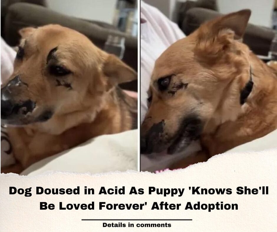 Dog Doused in Acid As Puppy ‘Knows She’ll Be Loved Forever’ After Adoption